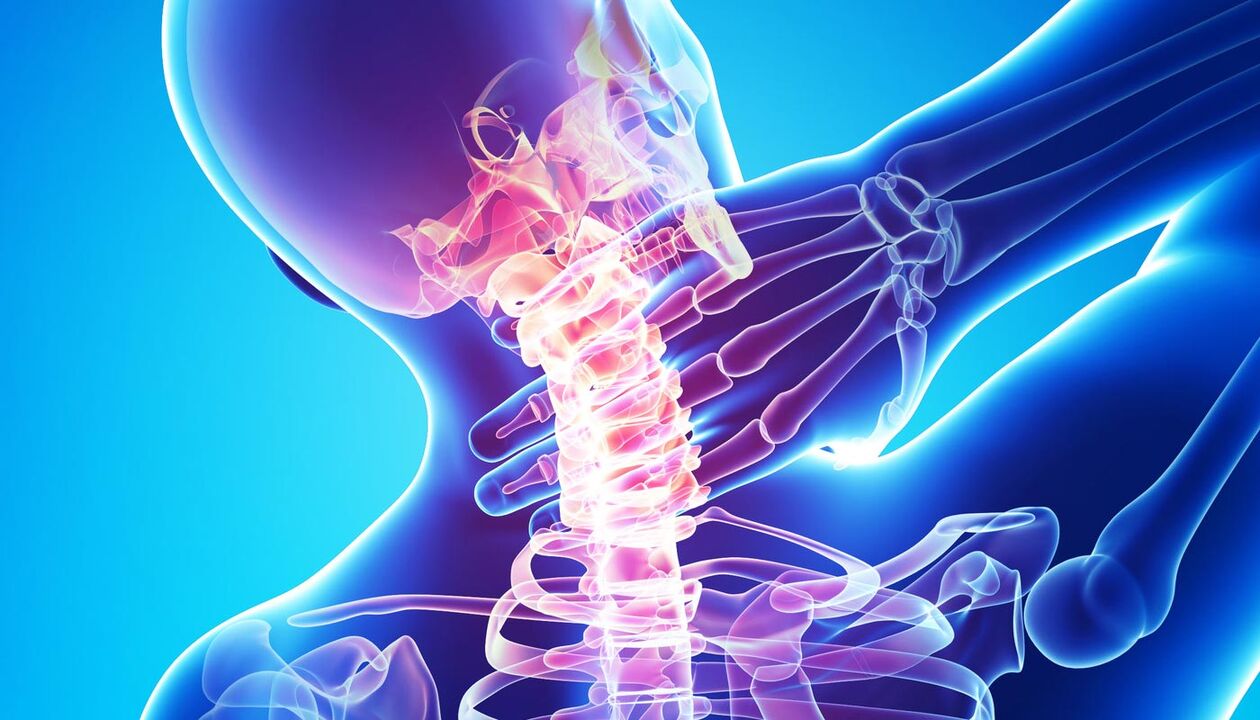 ból szyi z powodu osteochondrozy