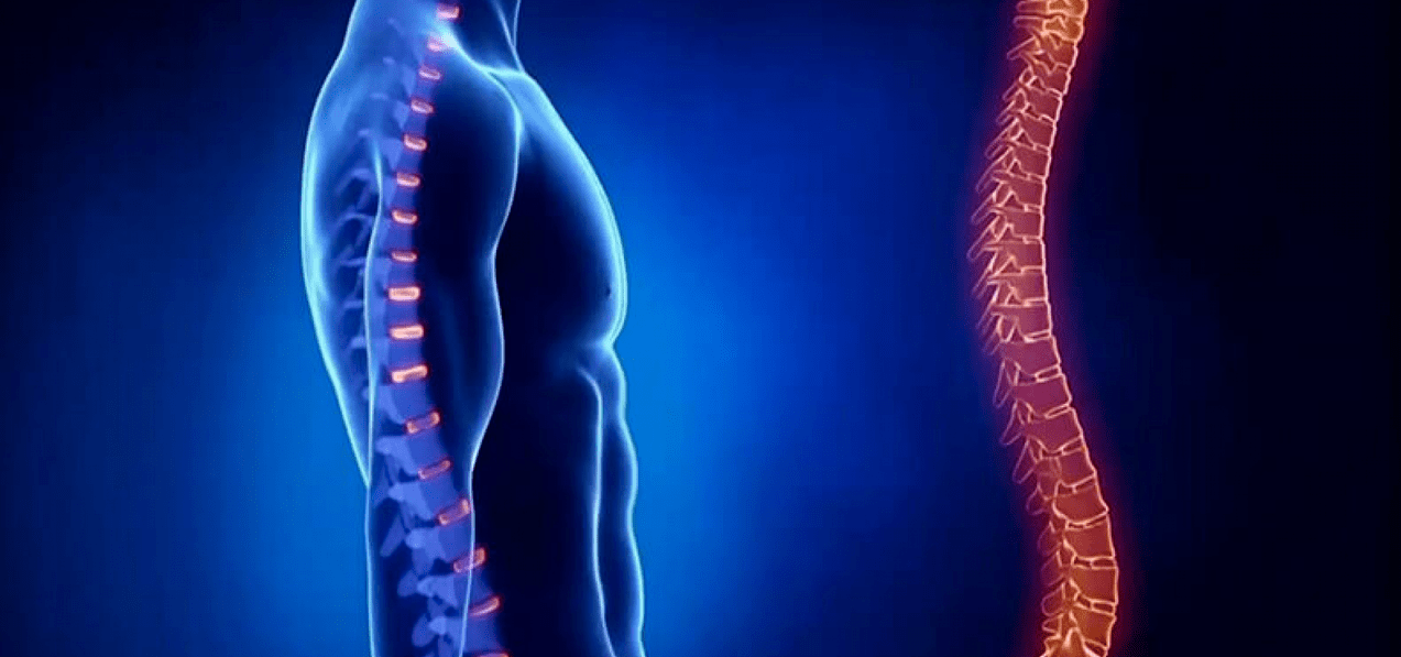 zmiany kręgosłupa spowodowane osteochondrozą